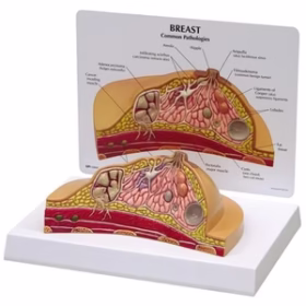 Full size Breast Cross Section Model