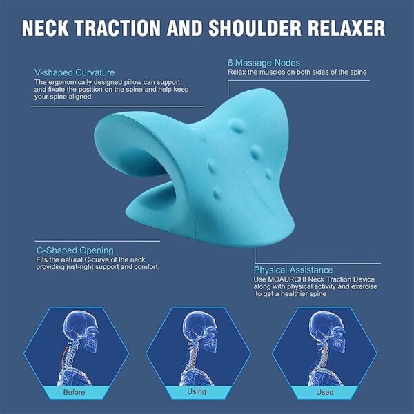It's important to note that cervical pillows may not be suitable for everyone, and some people may find them too high or firm. However, for many, they can be a valuable tool for improving sleep quality and reducing neck and shoulder pain.