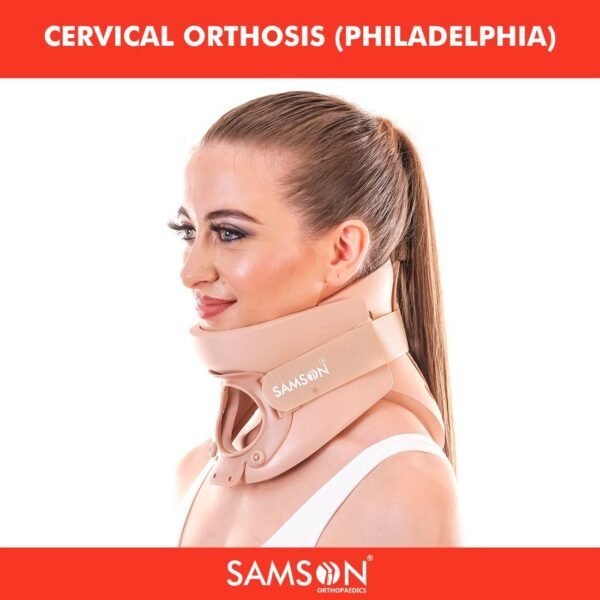 Samson Philadelphia collar, also known as a Cervical Orthosis (Philadelphia), is a rigid neck brace used to immobilize the cervical spine (neck) after injury or surgery. It's designed to prevent flexion, extension, and rotation of the neck, promoting healing by minimizing movement. It's often used in cases of neck fractures, head injuries, post-operative care, and for managing chronic neck conditions.