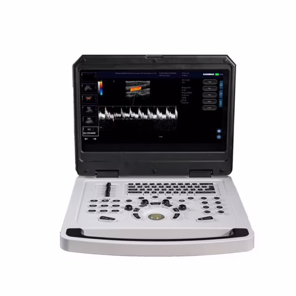 Specifications and Features: Imaging Modes: The IN-A880 supports various imaging modes, including B mode, M mode, Color (color Doppler) mode, PDI (Power Doppler) mode, and PW (Pulse Doppler) mode [tool_code:7]. Dual Operating Systems: It features dual, independent operating systems: an ultrasound system and a Win7 or above workstation system. This setup allows for independent operation of both systems without switching [tool_code:7]. Telemedicine Capabilities: The machine can facilitate remote medical services through its built-in Wi-Fi connection and application software. This enables image and video transmission, expert remote guidance, and real-time online training [tool_code:7]. Applications: It is suitable for ultrasonic diagnostic examinations of the human abdomen, superficial and small organs, and peripheral blood vessels [tool_code:7].