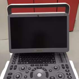 Sonoscape E2 Portable Color Doppler Ultrasound Scanner. Advanced digital imaging with high accuracy, portability, and reliable diagnostic performance.