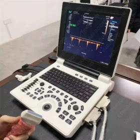 Echocardiography Multiprobe Ultrasound Machines, typically offer a range of specifications and features designed for portability and diagnostic accuracy. Specifications: Dimensions & Weight: Approximately 310 × 295 × 70 mm (LxWxH) and around 2.5 kg to 4 kg. Display: 12-inch LED or LCD screen. Power: Supply Voltage 100V-240V, 50/60Hz, 14V DC, with a 5200mAh rechargeable Li-Ion battery providing several hours of operation (e.g., 3-4 hours work time, 8 hours standby). Probes: Support for various probes like convex, linear, cavity, and micro-convex. Connectivity: DICOM format I/O function. Features: Imaging Modes: Support for multiple imaging modes including B, B/B, 4B, B+M, M, and sometimes advanced modes like CFM, B+CFM, PDI, B+PDI, and PW Doppler. Operating System: Often based on a PC platform like Windows 7. Portability: Slim laptop design for easy transport and use in various clinical settings. Applications: Suitable for a wide range of diagnostic applications, including abdominal, blood vessel, OB/GYN, and superficial organ examinations, and can also be adapted for veterinary use. User Interface: Designed for convenient operation with a clear display and intuitive controls.