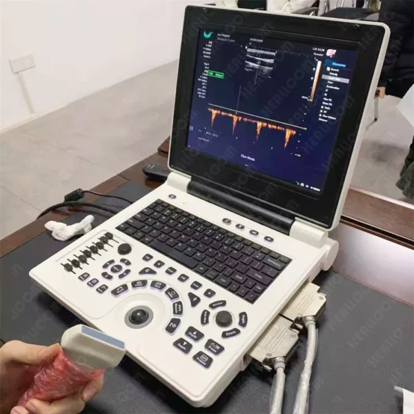 Echocardiography Multiprobe Ultrasound Machines, typically offer a range of specifications and features designed for portability and diagnostic accuracy. Specifications: Dimensions & Weight: Approximately 310 × 295 × 70 mm (LxWxH) and around 2.5 kg to 4 kg. Display: 12-inch LED or LCD screen. Power: Supply Voltage 100V-240V, 50/60Hz, 14V DC, with a 5200mAh rechargeable Li-Ion battery providing several hours of operation (e.g., 3-4 hours work time, 8 hours standby). Probes: Support for various probes like convex, linear, cavity, and micro-convex. Connectivity: DICOM format I/O function. Features: Imaging Modes: Support for multiple imaging modes including B, B/B, 4B, B+M, M, and sometimes advanced modes like CFM, B+CFM, PDI, B+PDI, and PW Doppler. Operating System: Often based on a PC platform like Windows 7. Portability: Slim laptop design for easy transport and use in various clinical settings. Applications: Suitable for a wide range of diagnostic applications, including abdominal, blood vessel, OB/GYN, and superficial organ examinations, and can also be adapted for veterinary use. User Interface: Designed for convenient operation with a clear display and intuitive controls.