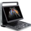 Sonoscape E2 is a portable color Doppler ultrasound system that supports cardiac imaging via phased array probes and abdominal imaging with a standard convex probe, incorporating features like B-mode, M-mode, color Doppler (CFM/PDI), Tissue Harmonic Imaging (THI), and speckle reduction μ-Scan technology. It features a 15.6" LCD monitor, integrated patient data management, DICOM support, and includes standard software functionalities such as Auto Optimization, PW Auto Trace, and a Biopsy Guide, with optional ECG module for enhanced workflow. Standard Hardware & Features Display: 15.6-inch high-resolution LCD color monitor with auto-adaptive LED backlight. Storage: 500 GB hard disk for data storage and USB 2.0 ports. Connectivity: Two transducer connector ports. Power: Built-in battery for portability. Ergonomics: Lightweight (approx. 6.5kg), making it suitable for various clinical settings. Standard Imaging Modes & Technologies 2D Imaging: B-mode, 2B/4B dual display, Spatial Compound Imaging, and Widescan Trapezoid imaging. Color Doppler: Color Doppler Flow Imaging (CFM), Power Doppler (PDI), and Directional Power Doppler (DirPDI). Harmonic Imaging: Tissue Harmonic Imaging (THI) and Pure Inversion Harmonic Imaging (PHI). Motion Imaging: M-mode and Color M-mode. Pulsed Wave (PW): PW mode with PW Auto Trace functionality. Speckle Reduction: μ-Scan technology for reducing 2D image noise. Cardiac Probes & Cardiac Applications While the standard probes are linear and convex, a cardiac probe (like a phased array) is an optional accessory for cardiac applications. The system supports cardiac imaging through its various modes and functionalities. Convex Probes & General Applications The Sonoscape E2 typically comes with a standard 3C-A convex array probe for abdominal, OB/GYN, and other applications. The system supports Widescan Convex Extended Imaging for enlarging the image view. ECG Software Integration The Sonoscape E2 supports an optional ECG module, allowing for the integration of ECG data for improved workflow and comprehensive patient assessment. Other Advanced Features Auto Optimization: Automates B, M, PW, and CW modes for quick image adjustment. Auto IMT: Automated measurement of Intima-Media Thickness. DICOM 3.0: Support for Store and Send functions. Steering & Biopsy: 2D Steer for beam direction and a Biopsy Guide. Optional Technologies: Options may include CW, TDI, AMM, SR Flow, Vis-Needle, B Mode Prospective Saving, and 2D Panoramic Imaging.