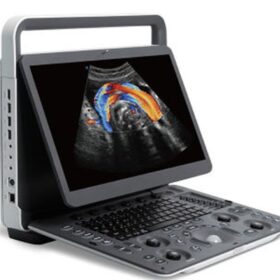 Sonoscape E2 is a portable color Doppler ultrasound system that supports cardiac imaging via phased array probes and abdominal imaging with a standard convex probe, incorporating features like B-mode, M-mode, color Doppler (CFM/PDI), Tissue Harmonic Imaging (THI), and speckle reduction μ-Scan technology. It features a 15.6" LCD monitor, integrated patient data management, DICOM support, and includes standard software functionalities such as Auto Optimization, PW Auto Trace, and a Biopsy Guide, with optional ECG module for enhanced workflow. Standard Hardware & Features Display: 15.6-inch high-resolution LCD color monitor with auto-adaptive LED backlight. Storage: 500 GB hard disk for data storage and USB 2.0 ports. Connectivity: Two transducer connector ports. Power: Built-in battery for portability. Ergonomics: Lightweight (approx. 6.5kg), making it suitable for various clinical settings. Standard Imaging Modes & Technologies 2D Imaging: B-mode, 2B/4B dual display, Spatial Compound Imaging, and Widescan Trapezoid imaging. Color Doppler: Color Doppler Flow Imaging (CFM), Power Doppler (PDI), and Directional Power Doppler (DirPDI). Harmonic Imaging: Tissue Harmonic Imaging (THI) and Pure Inversion Harmonic Imaging (PHI). Motion Imaging: M-mode and Color M-mode. Pulsed Wave (PW): PW mode with PW Auto Trace functionality. Speckle Reduction: μ-Scan technology for reducing 2D image noise. Cardiac Probes & Cardiac Applications While the standard probes are linear and convex, a cardiac probe (like a phased array) is an optional accessory for cardiac applications. The system supports cardiac imaging through its various modes and functionalities. Convex Probes & General Applications The Sonoscape E2 typically comes with a standard 3C-A convex array probe for abdominal, OB/GYN, and other applications. The system supports Widescan Convex Extended Imaging for enlarging the image view. ECG Software Integration The Sonoscape E2 supports an optional ECG module, allowing for the integration of ECG data for improved workflow and comprehensive patient assessment. Other Advanced Features Auto Optimization: Automates B, M, PW, and CW modes for quick image adjustment. Auto IMT: Automated measurement of Intima-Media Thickness. DICOM 3.0: Support for Store and Send functions. Steering & Biopsy: 2D Steer for beam direction and a Biopsy Guide. Optional Technologies: Options may include CW, TDI, AMM, SR Flow, Vis-Needle, B Mode Prospective Saving, and 2D Panoramic Imaging.