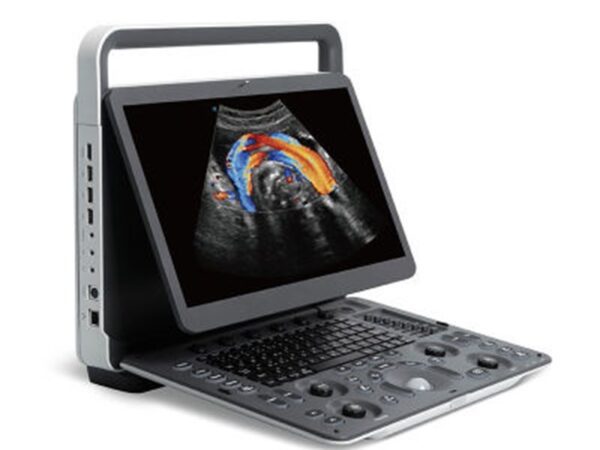 Sonoscape E2 is a portable color Doppler ultrasound system that supports cardiac imaging via phased array probes and abdominal imaging with a standard convex probe, incorporating features like B-mode, M-mode, color Doppler (CFM/PDI), Tissue Harmonic Imaging (THI), and speckle reduction μ-Scan technology. It features a 15.6" LCD monitor, integrated patient data management, DICOM support, and includes standard software functionalities such as Auto Optimization, PW Auto Trace, and a Biopsy Guide, with optional ECG module for enhanced workflow. Standard Hardware & Features Display: 15.6-inch high-resolution LCD color monitor with auto-adaptive LED backlight. Storage: 500 GB hard disk for data storage and USB 2.0 ports. Connectivity: Two transducer connector ports. Power: Built-in battery for portability. Ergonomics: Lightweight (approx. 6.5kg), making it suitable for various clinical settings. Standard Imaging Modes & Technologies 2D Imaging: B-mode, 2B/4B dual display, Spatial Compound Imaging, and Widescan Trapezoid imaging. Color Doppler: Color Doppler Flow Imaging (CFM), Power Doppler (PDI), and Directional Power Doppler (DirPDI). Harmonic Imaging: Tissue Harmonic Imaging (THI) and Pure Inversion Harmonic Imaging (PHI). Motion Imaging: M-mode and Color M-mode. Pulsed Wave (PW): PW mode with PW Auto Trace functionality. Speckle Reduction: μ-Scan technology for reducing 2D image noise. Cardiac Probes & Cardiac Applications While the standard probes are linear and convex, a cardiac probe (like a phased array) is an optional accessory for cardiac applications. The system supports cardiac imaging through its various modes and functionalities. Convex Probes & General Applications The Sonoscape E2 typically comes with a standard 3C-A convex array probe for abdominal, OB/GYN, and other applications. The system supports Widescan Convex Extended Imaging for enlarging the image view. ECG Software Integration The Sonoscape E2 supports an optional ECG module, allowing for the integration of ECG data for improved workflow and comprehensive patient assessment. Other Advanced Features Auto Optimization: Automates B, M, PW, and CW modes for quick image adjustment. Auto IMT: Automated measurement of Intima-Media Thickness. DICOM 3.0: Support for Store and Send functions. Steering & Biopsy: 2D Steer for beam direction and a Biopsy Guide. Optional Technologies: Options may include CW, TDI, AMM, SR Flow, Vis-Needle, B Mode Prospective Saving, and 2D Panoramic Imaging.